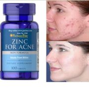 Zinc For acne Pattanás elleni komplex tabletta 100 db